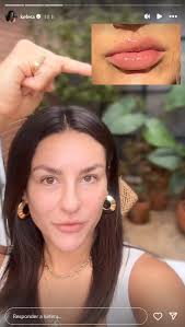 Kéfera Buchmann remove procedimentos estéticos