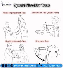 Image result for Drop Arm Test