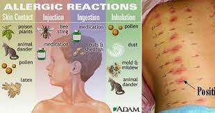 Pin On Allergies