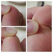 Hair Splinter Not Even My First One Imgur