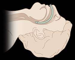 Носовая трубка