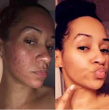 Turmeric Soap (with 100% Aloe Vera by Aloe4life)