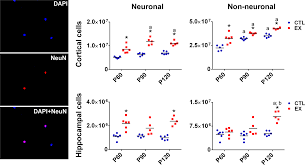 We did not find results for: Early Exercise Induces Long Lasting Morphological Changes In Cortical And Hippocampal Neurons Throughout Of A Sedentary Period Of Rats Scientific Reports
