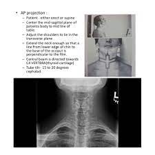 Ap Soft Tissue Neck Medical Radiography Radiologic Technology Sagittal Plane