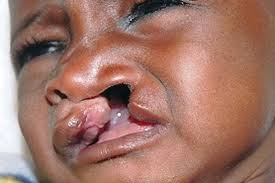 My rescue mission: Dr Michael McBrien