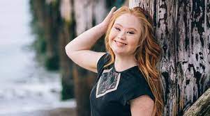 Nazývá se jinak i trizomie, aneuploidie atd. Model With Down Syndrome Walks At New York Fashion Week Poses For Vogue Inspires Us All