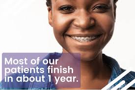 How Long Does It Take For Braces To Work