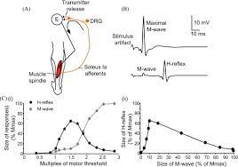 This brief review describes the basic procedure for evoking the h reflex in different muscles. The H Reflex As A Probe Pathways And Pitfalls Sciencedirect