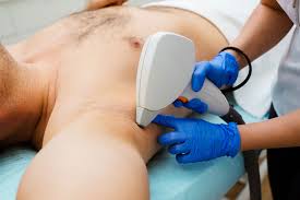 Underarm laser hair removal typically takes around 15 minutes, where full arm laser hair removal will likely be closer to 30 minutes. Underarm Laser Hair Removal In Toronto For Men Women Vs Medspa