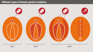 Besonders gravierend sind sowohl für die opfer als auch für die gesamte gesellschaft die psychischen und sozialen folgen Https Www Centrum3 At Fileadmin Downloads Vwa 2020 Vwa Pabinger Fgm Pdf