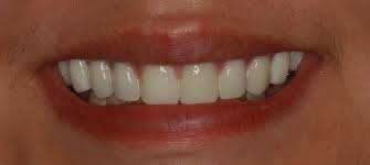 Finding a 24 hour emergency dentist in las vegas. Experienced Las Vegas Dentist Lasting Smiles Dental Care Las Vegas