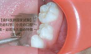小児歯科学】小児の口腔：幼若永久歯の特徴 | DENTAL YOUTH SHARE