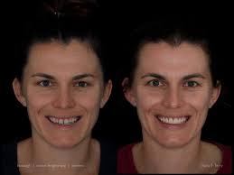 Ricky Lim (@rickylim.pros) • Instagram photos and videos