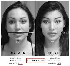 Cosmetic Surgery & Plastic Surgeon Chicago