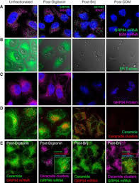 We did not find results for: Multifunctional Roles For The Protein Translocation Machinery In Rna Anchoring To The Endoplasmic Reticulum Journal Of Biological Chemistry