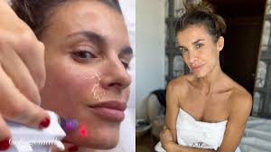 Elisabetta Canalis, a cosa serve il trattamento con collagene e laser sul  viso