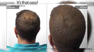 Mane is an organic micro fiber spray. Mane America Hair Thickening Spray The 1 Hair Loss Solution Youtube