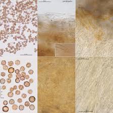 Image result for Scleroderma polyrhizon