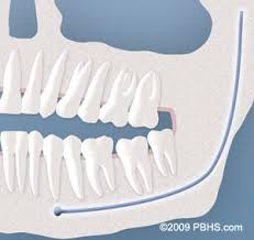 We did not find results for: Impacted Wisdom Teeth West Bloomfield Mi Farmington Hills