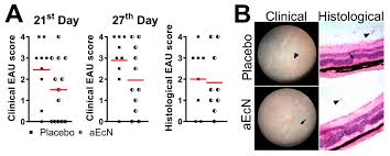 Universitas negeri medan atau biasa di singkat menjadi unimed adalah universitas tinggi negeri yang di dirikan pada tanggal 23 juni 1963 yang … Cells Free Full Text Severity Of Experimental Autoimmune Uveitis Is Reduced By Pretreatment With Live Probiotic Escherichia Coli Nissle 1917 Html