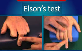 Image result for Elson Extensor Tendon Test