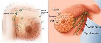 The most common altered genes are called brca1. 4 Male Breast Cancer Symptoms Because It Noticed In Male Community Also Public Health First Top Health Opd Care Of India