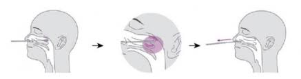This rapid antigen test has been used for months by health care providers, but on march 31, the fda also, avoid blowing your nose right before you take the test. Buy Covid 19 Antigen Rapid Test Kit Lateral Flow Covid 19 Test Quadratech Diagnostics