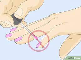 3 Ways To Get Rid Of White Spots On Your Nails - Wikihow