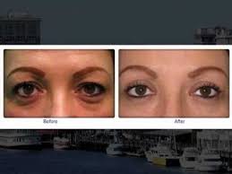 Dr Deidra Blanks Is A Wilmington Nc Plastic Surgeon Who Focuses On Facial Plastic Surgery Some People H Facial Plastic Facial Plastic Surgery Plastic Surgeon