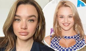 Hunter King shames 'rude' trolls for 'hurtful' accusation of lip fillers...  after swollen lip selfie