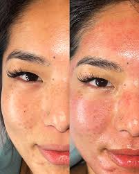 Bianca Webster, L.E., L.C.🫧 (@b_isforbeauty__) · Minneapolis, MN