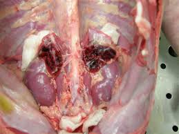 Pathology Outlines Waterhouse Friderichsen Syndrome