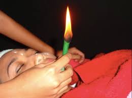 Ia menggunakan kain putih yang dinyalakan api sambil diletakkan pada keseluruhan muka secara berperingkat. Mitos Ulat Muka Resdung