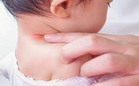 Itu bisa terjadi dengan sendirinya, tanpa batuk. Moms Perhatikan Gejala Covid 19 Pada Anak Berikut Ini Lifestyle Bisnis Com