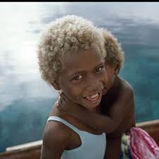 African With Natural Blonde Hair And Greenish Blue Eyes Real Or Photoshoped Black And Blonde Dark Skin Blonde Hair Natural Blondes