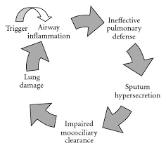 The Pathophysiology Of Bronchiectasis The Inflammatory Cycle
