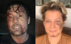 Deputada federal eleita por são paulo jornalista, escritora e biógrafa de sérgio moro Ricardo Macchi Appears Injured And Makes Fun Of Joice Hasselmann Attack Entertainment Prime Time Zone