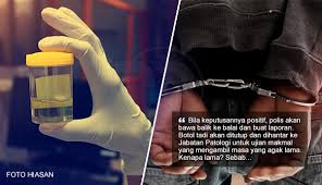 Model hiv/aids permainan darvih a. Kalau Libatkan Orang Kenamaan Lambat Je Tapi Orang Biasa Cepat Je Result Urine Test Keluar Kata Netizen Tapi Lelaki Ini Jelaskan Mengapa Prosedurnya Ambil Masa The Reporter