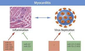 Myocarditis can occur when any infectious disease, but currently myocarditis is most often seen in viral infections. The Quest For New Approaches In Myocarditis And Inflammatory Cardiomyopathy Sciencedirect