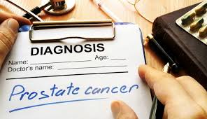 Risk factors include age, family history, ethnicity, and diet. What Is Active Surveillance For Prostate Cancer Md Anderson Cancer Center
