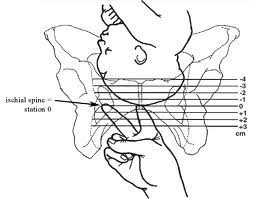 Medical Student Bishop Score