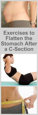 The Best Exercises To Flatten The Stomach After A C Section 1 C Section Workout After C Section Workout After Baby Workout