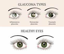 Pin On Eye Health