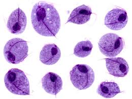 Image result for trichomonas images