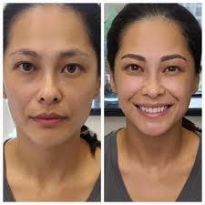 Meet Seung Szczechowski