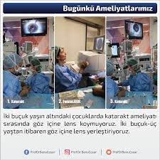 Iki Bucuk Yasin Altindaki Cocuklarda Katarakt Ameliyati Sirasinda Goz Icine Lens Koymuyoruz Iki Bucuk Uc Yastan Itibaren Goz Icine Lens Ye Sira Ikiz Yastiklar