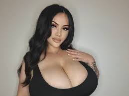 مرض نادر يجعل ثديي عارضة أزياء ينموان أربعة أضعاف حجمهما الطبيعي كل عام!  (شاهد)