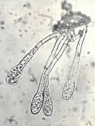 Image result for Uncinula necator