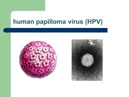 There are more than 200 types. Impfung Gegen Hpv Human Papilloma Viren Und Gegen Gebarmutterhalskrebs Jrg Ppt Video Online Herunterladen