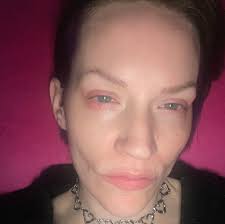 This is a good read for those of us who feel like they have a disability or  should be classified as disabled because they've been diagnosed with  Myositis.